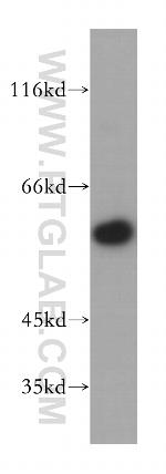 RFTN2 Antibody in Western Blot (WB)