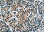 USP21 Antibody in Immunohistochemistry (Paraffin) (IHC (P))