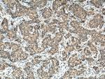 USP21 Antibody in Immunohistochemistry (Paraffin) (IHC (P))