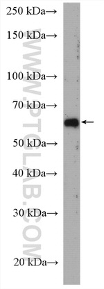 USP21 Antibody in Western Blot (WB)