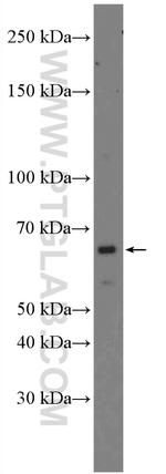 USP21 Antibody in Western Blot (WB)