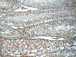 DDX10 Antibody in Immunohistochemistry (Paraffin) (IHC (P))