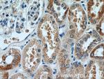 DDX10 Antibody in Immunohistochemistry (Paraffin) (IHC (P))