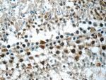 DDX10 Antibody in Immunohistochemistry (Paraffin) (IHC (P))