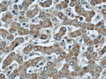 GCS1 Antibody in Immunohistochemistry (Paraffin) (IHC (P))