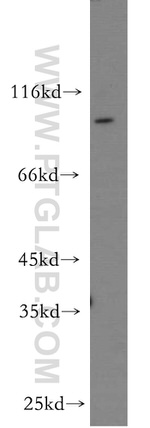 GCS1 Antibody in Western Blot (WB)