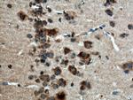 CACNG7 Antibody in Immunohistochemistry (Paraffin) (IHC (P))