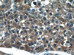 CYP2D6 Antibody in Immunohistochemistry (Paraffin) (IHC (P))