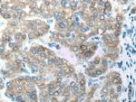 CYP2D6 Antibody in Immunohistochemistry (Paraffin) (IHC (P))