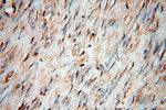 STS Antibody in Immunohistochemistry (Paraffin) (IHC (P))