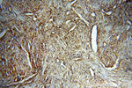 STS Antibody in Immunohistochemistry (Paraffin) (IHC (P))