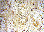 STS Antibody in Immunohistochemistry (Paraffin) (IHC (P))