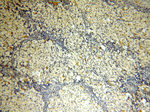 STS Antibody in Immunohistochemistry (Paraffin) (IHC (P))