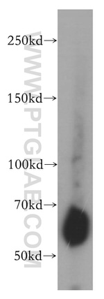 STS Antibody in Western Blot (WB)