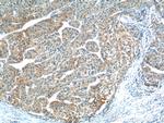 TP53INP1 Antibody in Immunohistochemistry (Paraffin) (IHC (P))