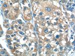 TP53INP1 Antibody in Immunohistochemistry (Paraffin) (IHC (P))