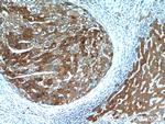 TP53INP1 Antibody in Immunohistochemistry (Paraffin) (IHC (P))