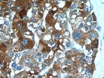 TP53INP1 Antibody in Immunohistochemistry (Paraffin) (IHC (P))