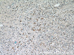 MMP3 Antibody in Immunohistochemistry (Paraffin) (IHC (P))