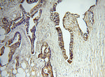 MMP3 Antibody in Immunohistochemistry (Paraffin) (IHC (P))