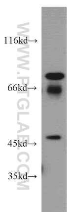 MMP3 Antibody in Western Blot (WB)