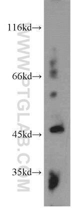 MMP3 Antibody in Western Blot (WB)