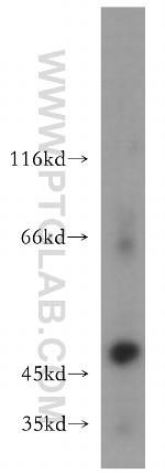 MMP3 Antibody in Western Blot (WB)