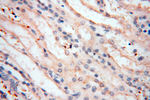 MMP8 Antibody in Immunohistochemistry (Paraffin) (IHC (P))