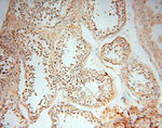 MMP8 Antibody in Immunohistochemistry (Paraffin) (IHC (P))