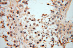 MMP8 Antibody in Immunohistochemistry (Paraffin) (IHC (P))