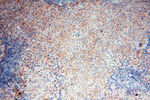 MMP8 Antibody in Immunohistochemistry (Paraffin) (IHC (P))