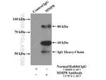 MMP8 Antibody in Immunoprecipitation (IP)