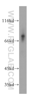 MMP8 Antibody in Western Blot (WB)