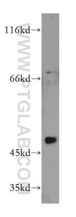 RANBP3L Antibody in Western Blot (WB)