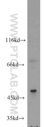 RANBP3L Antibody in Western Blot (WB)