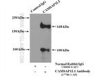 CAMSAP2 Antibody in Immunoprecipitation (IP)