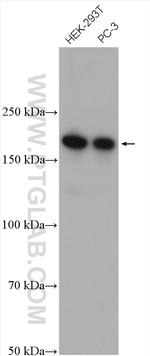 CAMSAP2 Antibody in Western Blot (WB)