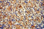 CAMSAP2 Antibody in Immunohistochemistry (Paraffin) (IHC (P))