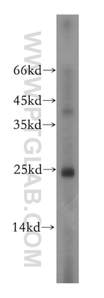 THOC7 Antibody in Western Blot (WB)