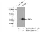 LIN9 Antibody in Immunoprecipitation (IP)