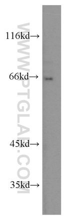 LIN9 Antibody in Western Blot (WB)