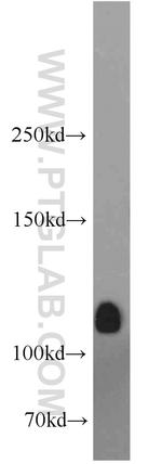 DGKQ Antibody in Western Blot (WB)