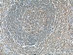 ADAMDEC1 Antibody in Immunohistochemistry (Paraffin) (IHC (P))