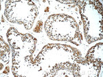 GAS1 Antibody in Immunohistochemistry (Paraffin) (IHC (P))