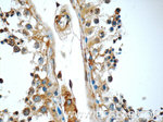 GAS1 Antibody in Immunohistochemistry (Paraffin) (IHC (P))