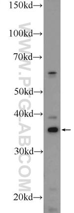 GAS1 Antibody in Western Blot (WB)