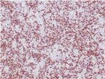 TdT/DNA Nucleotidylexotransferase Antibody in Immunohistochemistry (Paraffin) (IHC (P))