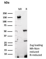 TdT/DNA Nucleotidylexotransferase Antibody in SDS-PAGE (SDS-PAGE)
