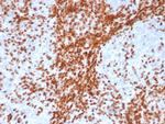 TdT/DNA Nucleotidylexotransferase (Acute Lymphoblastic Leukemia Marker) Antibody in Immunohistochemistry (Paraffin) (IHC (P))