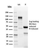 TdT/DNA Nucleotidylexotransferase (Acute Lymphoblastic Leukemia Marker) Antibody in SDS-PAGE (SDS-PAGE)
